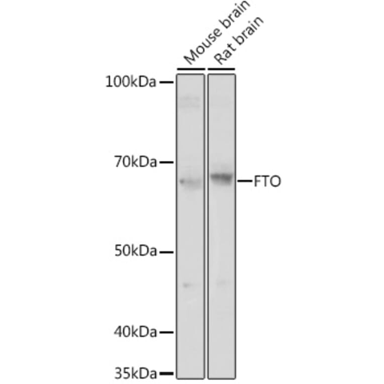 Western Blot - Anti-FTO Antibody (A307471) - Antibodies.com