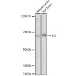 Western Blot - Anti-FTO Antibody (A307471) - Antibodies.com