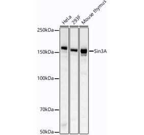 Western Blot - Anti-mSin3A Antibody [ARC54250] (A307472) - Antibodies.com