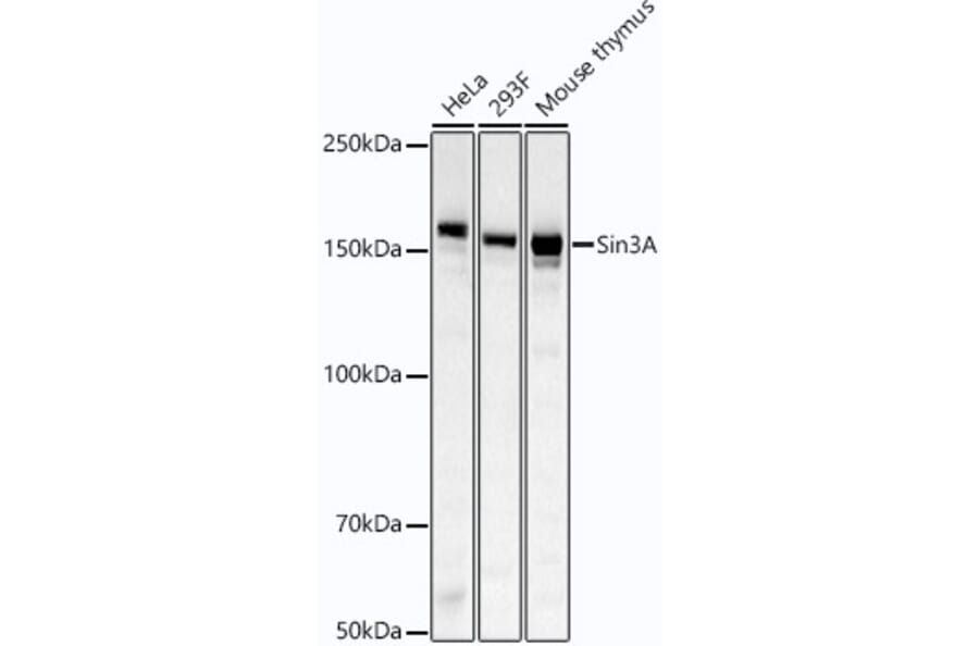 Western Blot - Anti-mSin3A Antibody [ARC54250] (A307472) - Antibodies.com