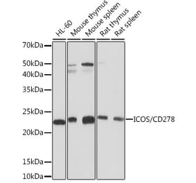 Western Blot - Anti-ICOS Antibody [ARC1148] (A307475) - Antibodies.com