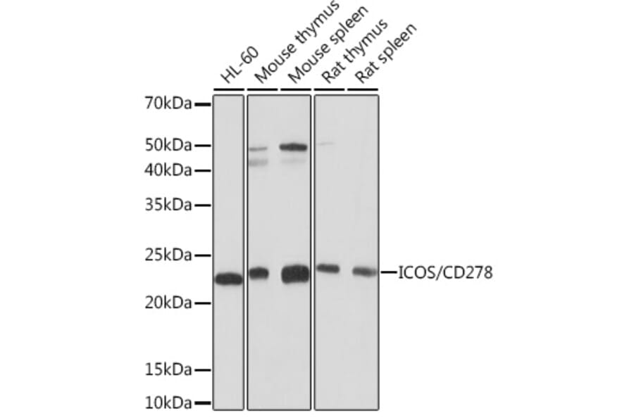 Western Blot - Anti-ICOS Antibody [ARC1148] (A307475) - Antibodies.com