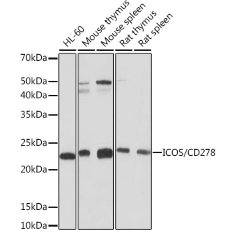 Western Blot - Anti-ICOS Antibody [ARC1148] (A307475) - Antibodies.com
