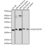 Western Blot - Anti-ICOS Antibody [ARC1148] (A307475) - Antibodies.com