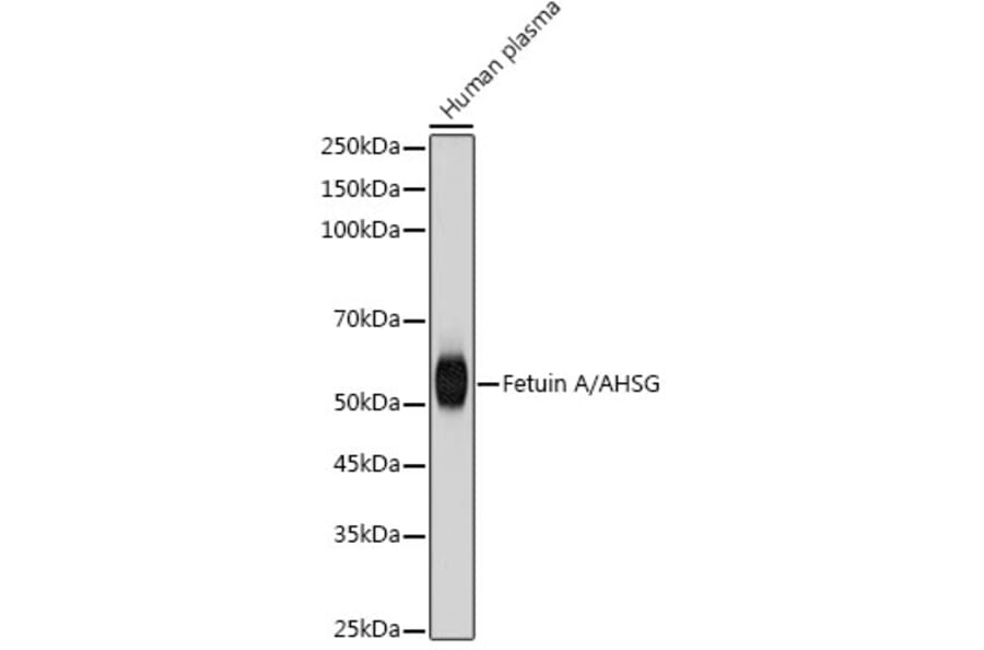 Western Blot - Anti-AHSG Antibody [ARC2433] (A307478) - Antibodies.com