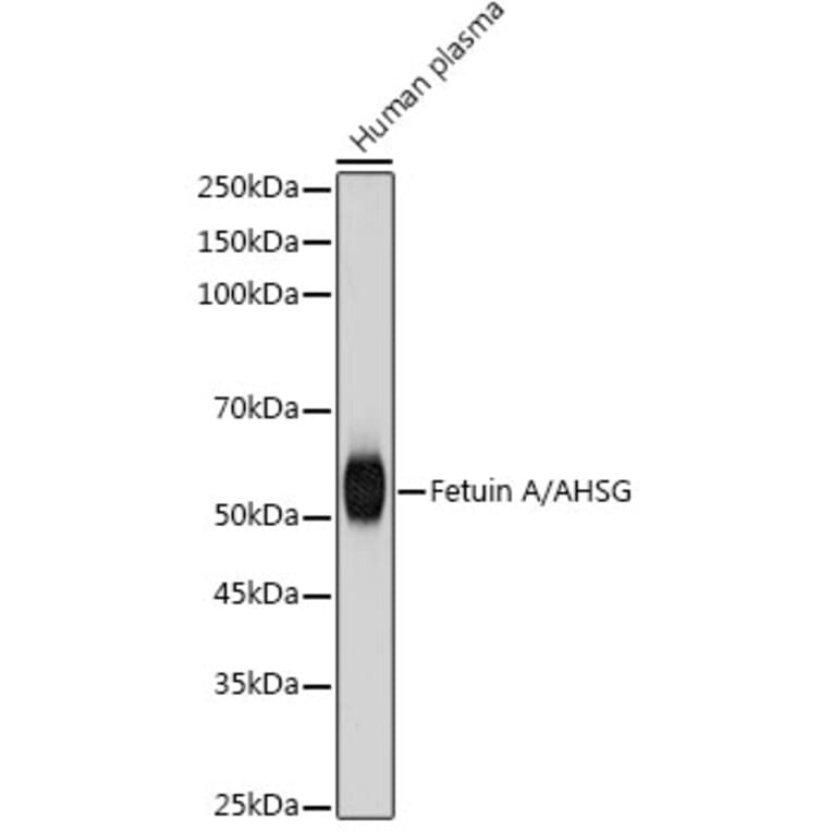 Western Blot - Anti-AHSG Antibody [ARC2433] (A307478) - Antibodies.com