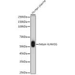 Western Blot - Anti-AHSG Antibody [ARC2433] (A307478) - Antibodies.com