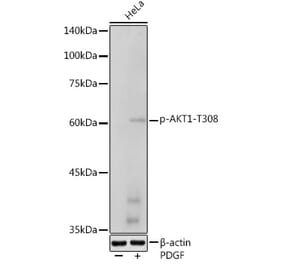 Western Blot - Anti-AKT1 (phospho Thr308) Antibody (A307479) - Antibodies.com