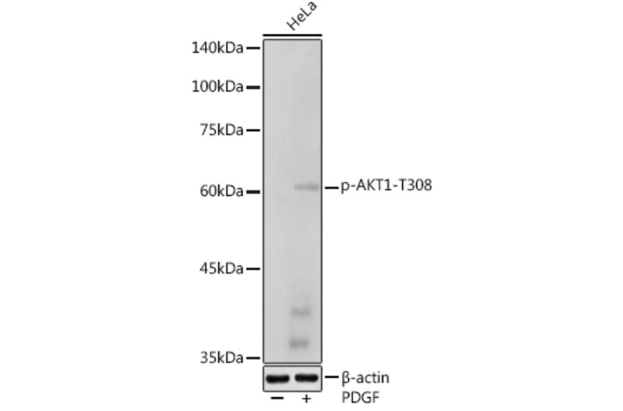 Western Blot - Anti-AKT1 (phospho Thr308) Antibody (A307479) - Antibodies.com