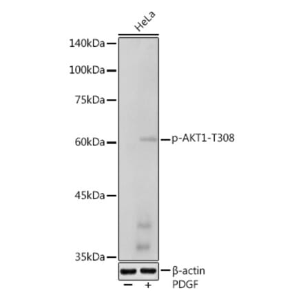 Western Blot - Anti-AKT1 (phospho Thr308) Antibody (A307479) - Antibodies.com