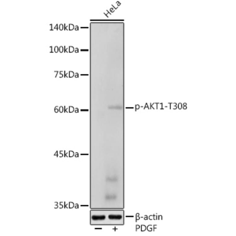 Western Blot - Anti-AKT1 (phospho Thr308) Antibody (A307479) - Antibodies.com