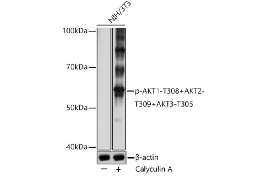 Western Blot - Anti-AKT1 (phospho Thr308) + AKT2 (phospho Thr309) + AKT3 (phospho Thr305) Antibody (A307481) - Antibodies.com