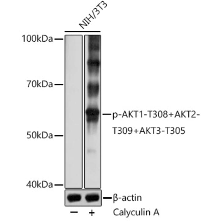 Western Blot - Anti-AKT1 (phospho Thr308) + AKT2 (phospho Thr309) + AKT3 (phospho Thr305) Antibody (A307481) - Antibodies.com