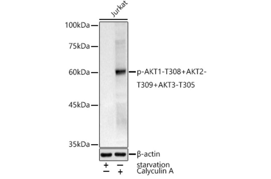 Western Blot - Anti-AKT1 (phospho Thr308) + AKT2 (phospho Thr309) + AKT3 (phospho Thr305) Antibody (A307482) - Antibodies.com