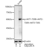 Western Blot - Anti-AKT1 (phospho Thr308) + AKT2 (phospho Thr309) + AKT3 (phospho Thr305) Antibody (A307482) - Antibodies.com