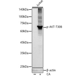 Western Blot - Anti-AKT1 (phospho Thr308) Antibody [ARC55284] (A307483) - Antibodies.com