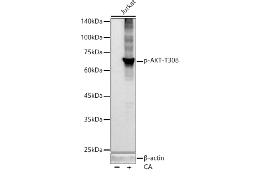 Western Blot - Anti-AKT1 (phospho Thr308) Antibody [ARC55284] (A307483) - Antibodies.com