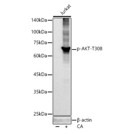 Western Blot - Anti-AKT1 (phospho Thr308) Antibody [ARC55284] (A307483) - Antibodies.com