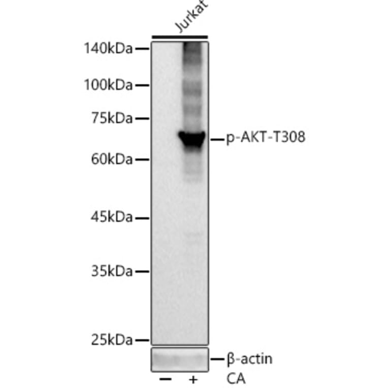 Western Blot - Anti-AKT1 (phospho Thr308) Antibody [ARC55284] (A307483) - Antibodies.com