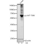 Western Blot - Anti-AKT1 (phospho Thr308) Antibody [ARC55284] (A307483) - Antibodies.com