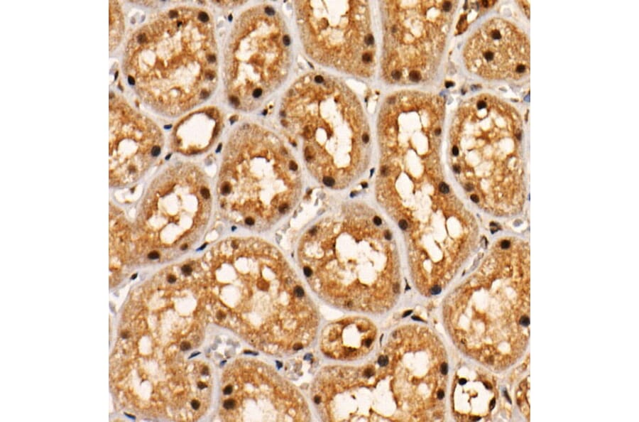 Immunohistochemistry - Anti-AKT1 (phospho Thr308) Antibody [ARC55284] (A307483) - Antibodies.com
