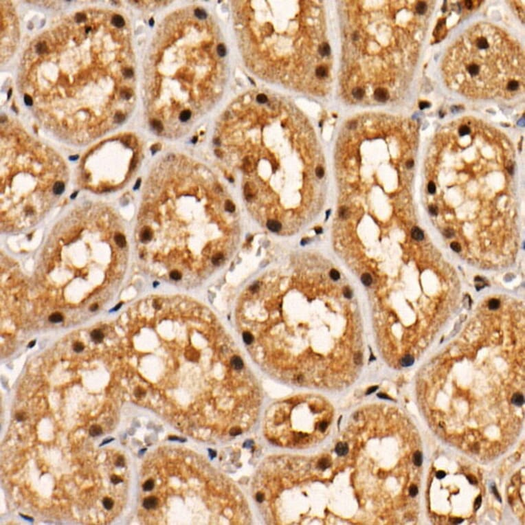 Immunohistochemistry - Anti-AKT1 (phospho Thr308) Antibody [ARC55284] (A307483) - Antibodies.com