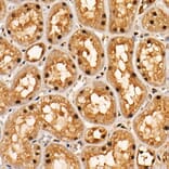 Immunohistochemistry - Anti-AKT1 (phospho Thr308) Antibody [ARC55284] (A307483) - Antibodies.com