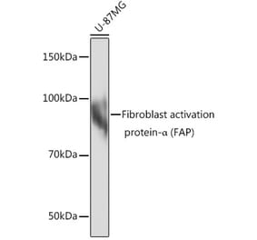 Western Blot - Anti-Fibroblast activation protein, alpha Antibody [ARC0634] (A307486) - Antibodies.com