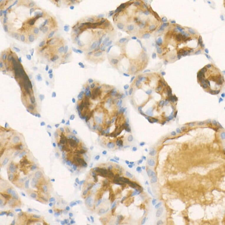 Immunohistochemistry - Anti-Pepsinogen II/PGC Antibody [ARC57717] (A307491) - Antibodies.com