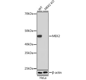 Western Blot - Anti-MEK2 Antibody [ARC0361] (A307492) - Antibodies.com