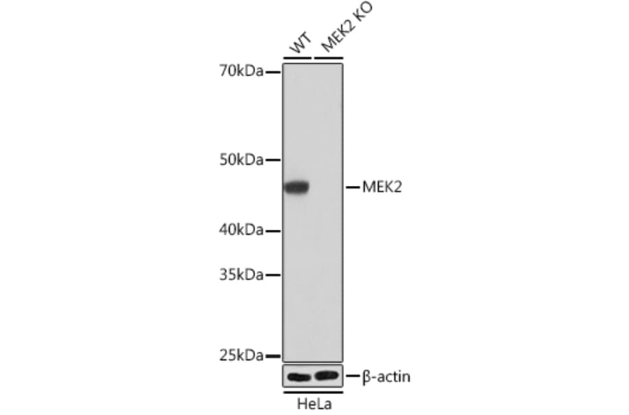 Western Blot - Anti-MEK2 Antibody [ARC0361] (A307492) - Antibodies.com