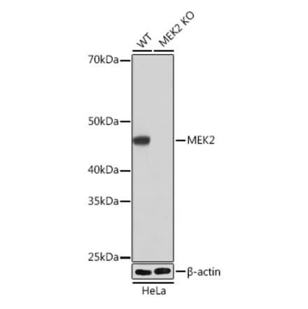 Western Blot - Anti-MEK2 Antibody [ARC0361] (A307492) - Antibodies.com
