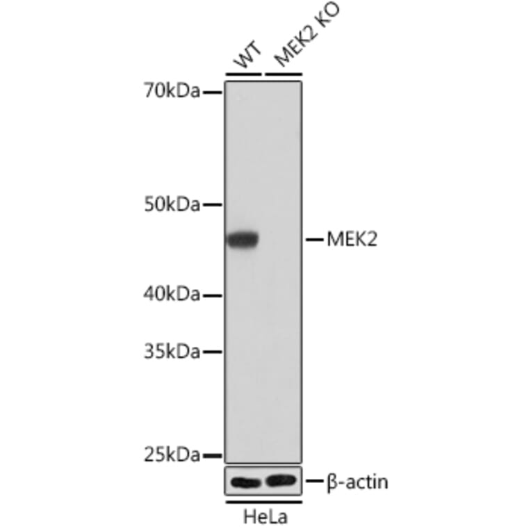 Western Blot - Anti-MEK2 Antibody [ARC0361] (A307492) - Antibodies.com