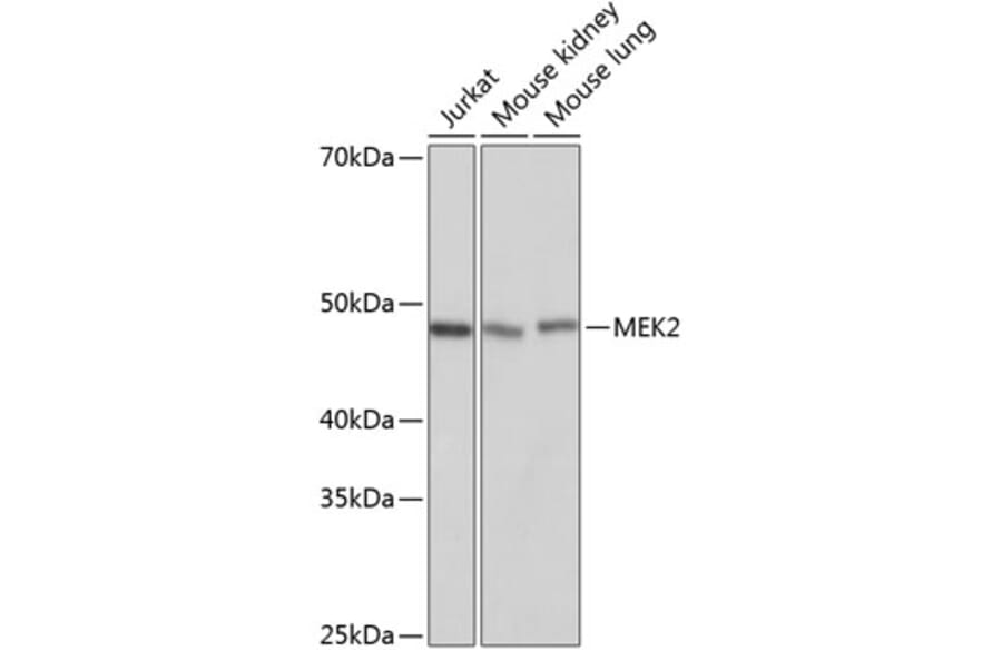 Western Blot - Anti-MEK2 Antibody [ARC0361] (A307492) - Antibodies.com