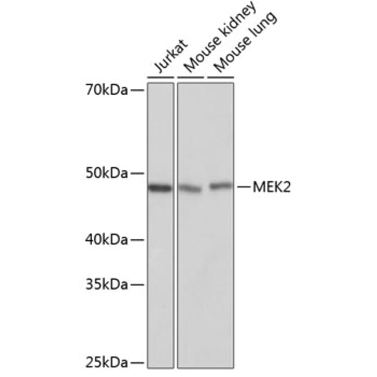 Western Blot - Anti-MEK2 Antibody [ARC0361] (A307492) - Antibodies.com