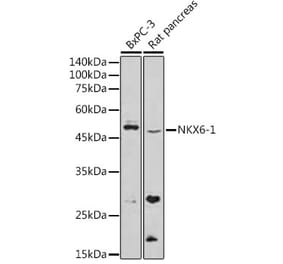 Western Blot - Anti-nkx6.1 Antibody (A307493) - Antibodies.com