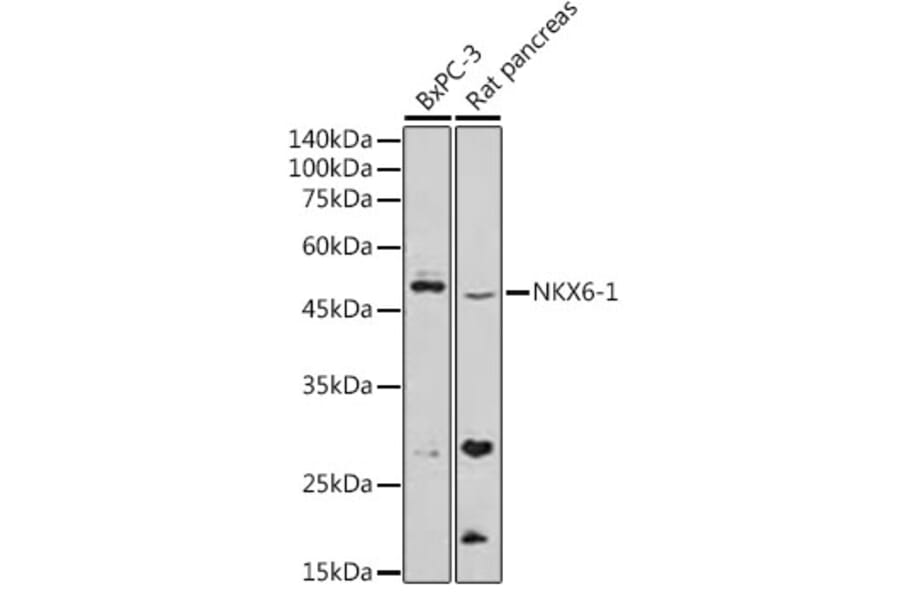 Western Blot - Anti-nkx6.1 Antibody (A307493) - Antibodies.com