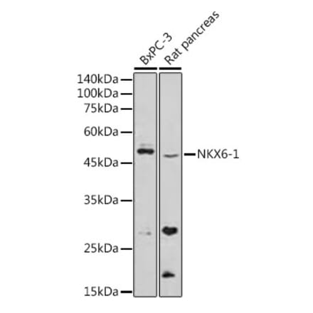 Western Blot - Anti-nkx6.1 Antibody (A307493) - Antibodies.com