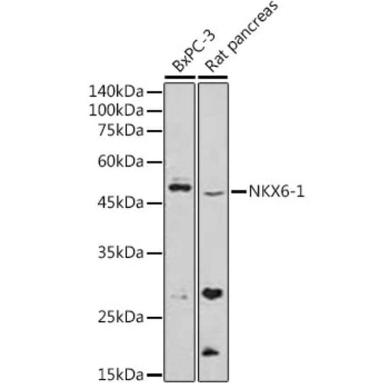 Western Blot - Anti-nkx6.1 Antibody (A307493) - Antibodies.com