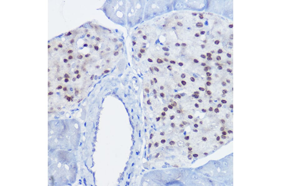 Immunohistochemistry - Anti-nkx6.1 Antibody (A307493) - Antibodies.com