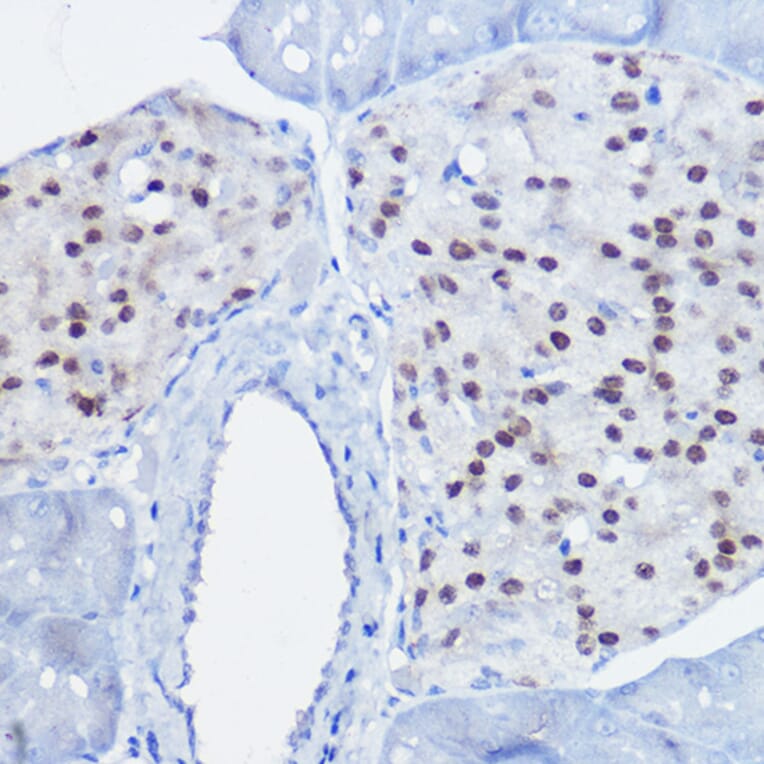 Immunohistochemistry - Anti-nkx6.1 Antibody (A307493) - Antibodies.com