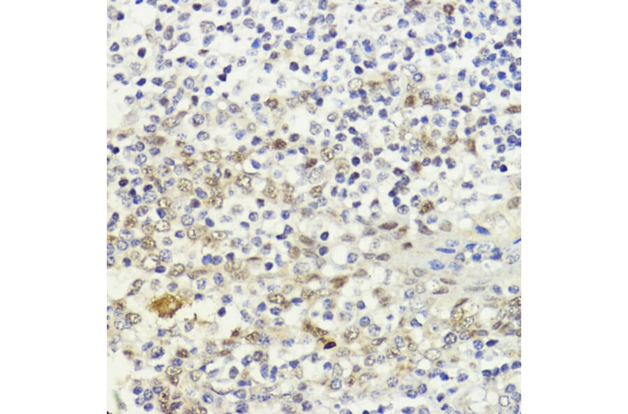 Immunohistochemistry - Anti-LDB1 Antibody (A307494) - Antibodies.com