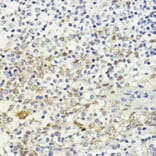 Immunohistochemistry - Anti-LDB1 Antibody (A307494) - Antibodies.com