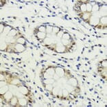 Immunohistochemistry - Anti-LDB1 Antibody (A307494) - Antibodies.com