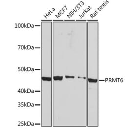 Western Blot - Anti-PRMT6 Antibody [ARC1277] (A307495) - Antibodies.com