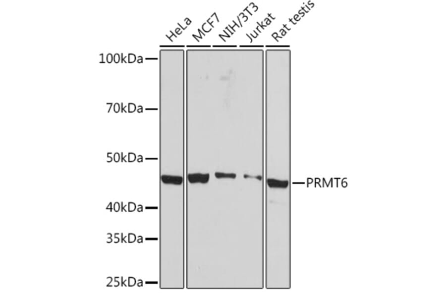 Western Blot - Anti-PRMT6 Antibody (A307495) - Antibodies.com