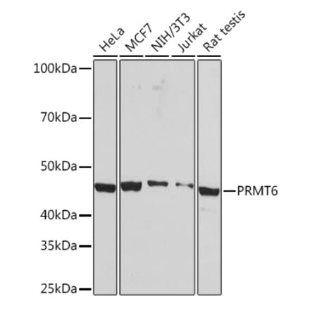 Western Blot - Anti-PRMT6 Antibody [ARC1277] (A307495) - Antibodies.com