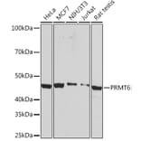 Western Blot - Anti-PRMT6 Antibody (A307495) - Antibodies.com
