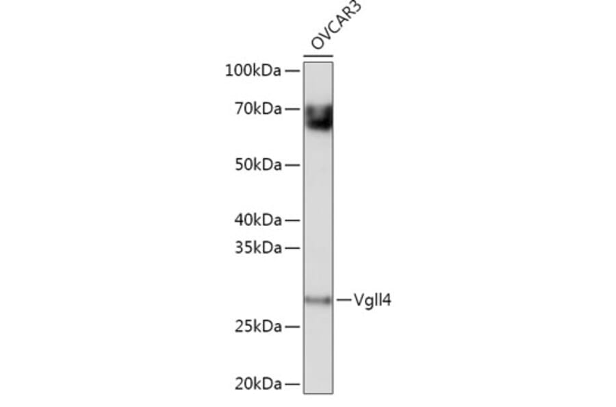 Western Blot - Anti-Vgll4 Antibody (A307497) - Antibodies.com