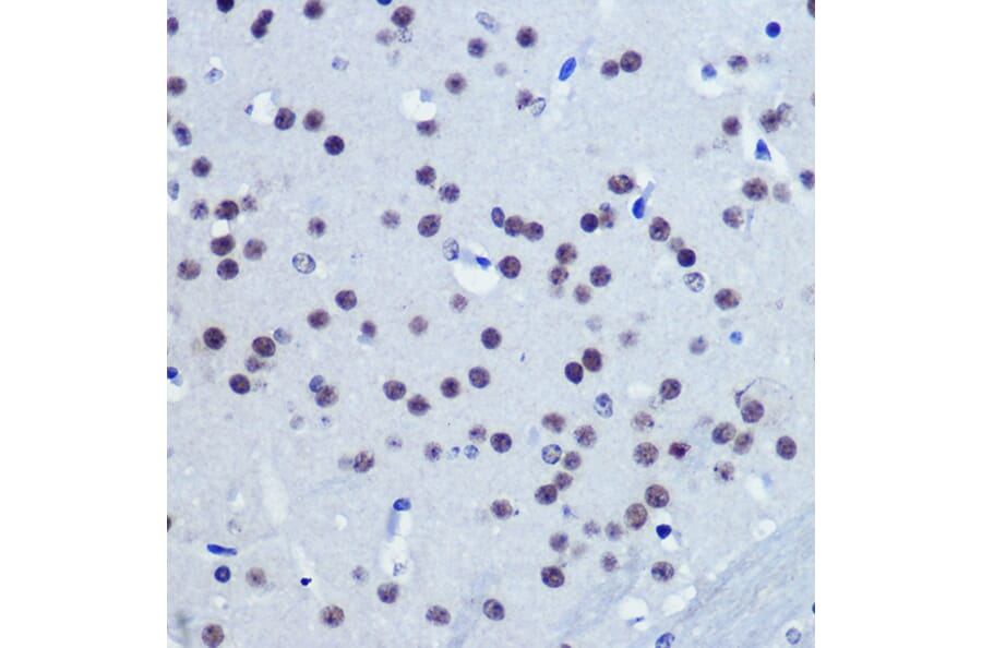 Immunohistochemistry - Anti-Vgll4 Antibody (A307497) - Antibodies.com